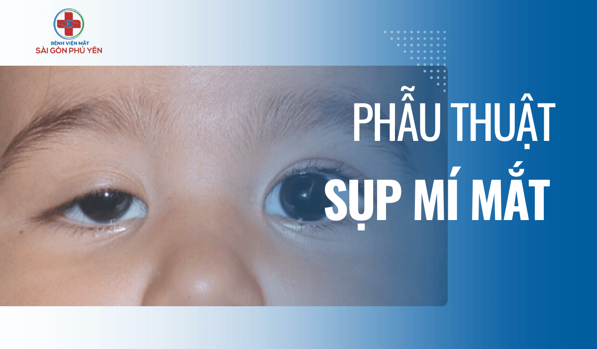 PHẪU THUẬT ĐIỀU TRỊ SỤP MI TẠI PHÚ YÊN