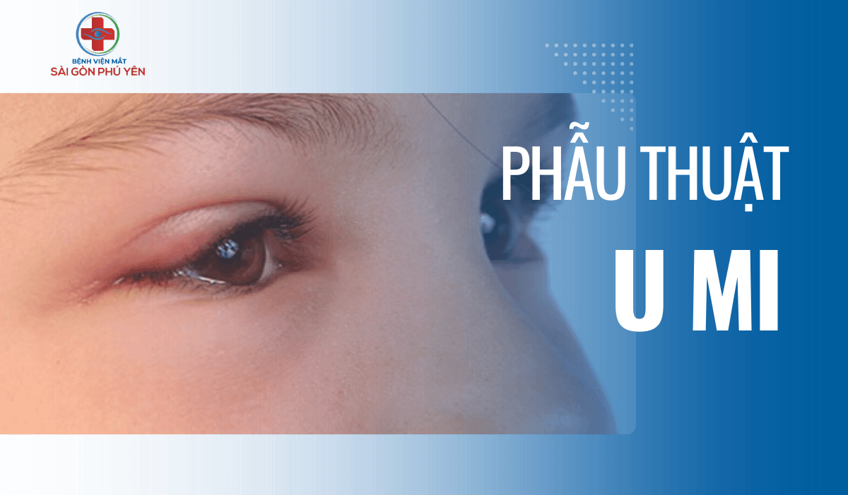 PHẪU THUẬT U MI MẮT TẠI PHÚ YÊN