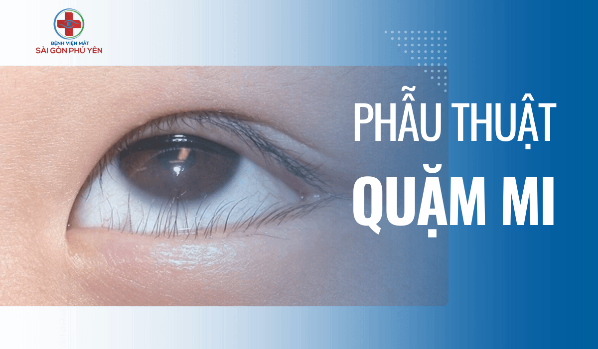 ĐIỀU TRỊ QUẶM MI TẠI PHÚ YÊN