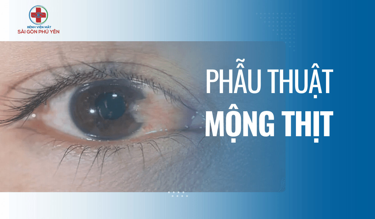 Phẫu thuật mộng thịt