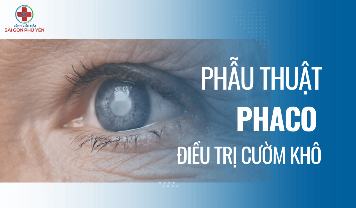 Phẫu thuật PHACO điều trị đục thủy tinh thể